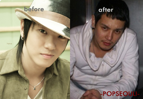 الفرق الكورية قبل عمليات التجميل 0517-before-after