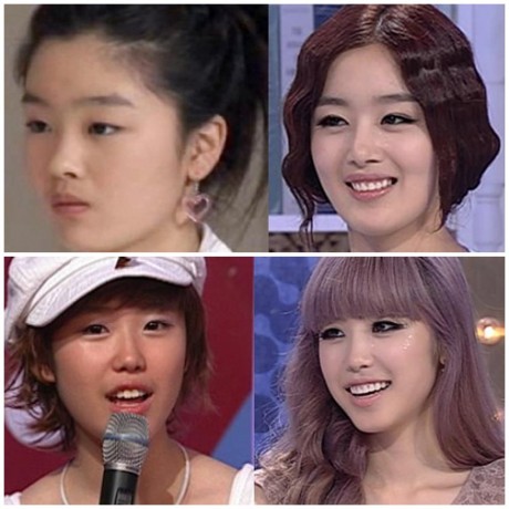 الفرق الكورية قبل عمليات التجميل 20100909_secretrevealsshockingauditionphotos_01-460x460
