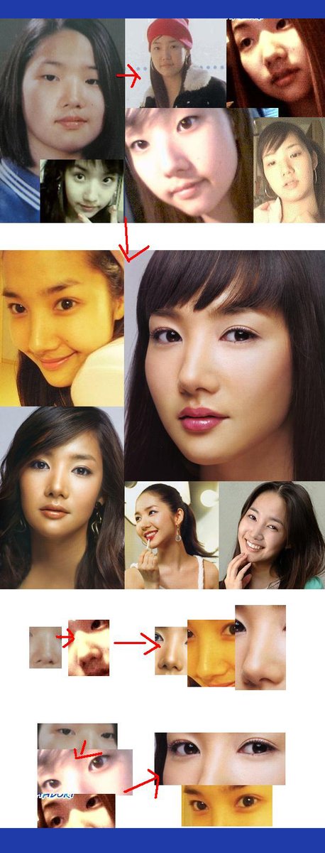الفرق الكورية قبل عمليات التجميل Photo-se-ywaokcdyaagpgkae1